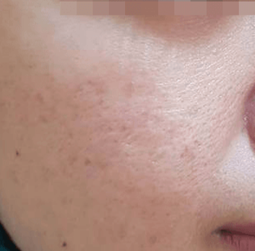 Before/After Image